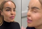 Katie Piper issues 'end of the road' health update after 'years of battling with eye'