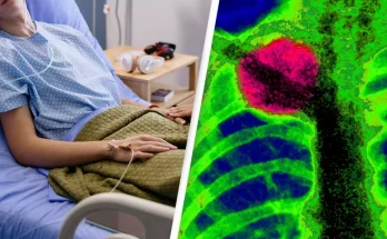 Teen boy was told by doctors he pulled a muscle but it ended up being rare terminal cancer