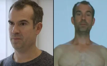 Doctor who switched to 80% ultra-processed food diet for 30 days revealed shocking before and after results