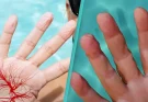 Bizarre simulation shows why fingers wrinkle when wet but it doesn't happen to everyone