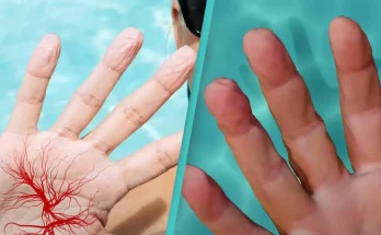 Bizarre simulation shows why fingers wrinkle when wet but it doesn't happen to everyone