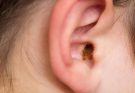 Epic Ear Wax Extraction: David vs. Goliath (Tiny Canal Edition!)