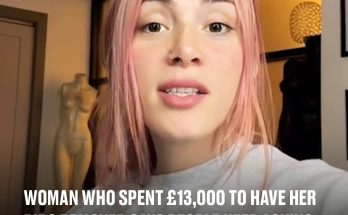 Woman who spent £13,000 to have her ribs removed says people keep asking if she is ‘going to eat them.’