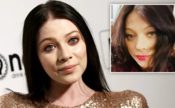 Michelle Trachtenberg addressed fans’ concerns over her ‘yellow eyes’ before her death