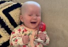 Twin baby girl born with incredibly rare condition that means she has no eyes