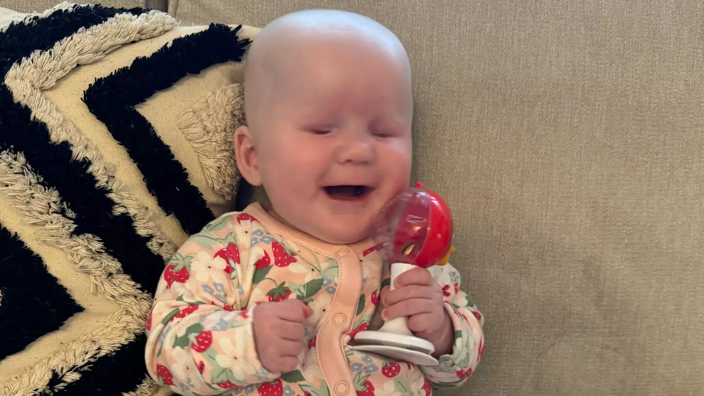 Twin baby girl born with incredibly rare condition that means she has no eyes