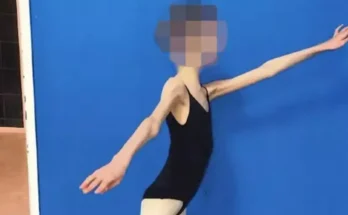 Parents who starved teenage ballerina daughter until she was four stone jailed for neglect