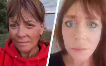 Woman reveals 'horror' surgery to fix her face after weight loss left her unable to close eyes even when she sleepsWoman reveals 'horror' surgery to fix her face after weight loss left her unable to close eyes even when she sleeps Home> News> Health Published 17:32 25 Feb 2025 GMT Woman reveals 'horror' surgery to fix her face after weight loss left her unable to close eyes even when she sleeps Joanne Law described the the hospital where she received treatment as being a 'butcher's shop' Joe Yates Joe Yates Warning: this article contains discussion of body image and beauty standards that some readers may find distressing A mom-of-two has been left unable to close her eyes after flying overseas to undergo cosmetic surgery on the cheap. Joanne Law forked out around $6,500 to fund a face, neck and eyelid lift, as well a fat graft, and while it may be still be an expensive venture, it would have cost her at least double that figure if she had opted for the same operation in her own country, England. In June, 2023, the 56-year-old took a four-hour flight across Europe to go under the knife, having visited the same hospital four months earlier, in February, where she underwent gastric sleeve surgery. Following the success of the first procedure led to Law shedding seven stone, and while she was excited about the weight-loss, it brought about its own problem. "When I lost seven stone I just felt wrinkly, so I thought this is my next step, I'll get my face done," Law, of Manchester, shared. Similar articles to this Powered by Mantis Logo Find more about Man who broke his own legs to add 9 inches to his height speaks out on his experience Man who broke his own legs to add 9 inches to his height speaks out on his experience Man who broke his own legs to add 9 inches to his height speaks out on his experience Find more about Sharon Osbourne reveals 'biggest mistake' she ever made in marriage to Ozzy Osbourne Sharon Osbourne reveals 'biggest mistake' she ever made in marriage to Ozzy Osbourne Sharon Osbourne reveals 'biggest mistake' she ever made in marriage to Ozzy Osbourne Find more about Doctor reveals the one personal item you shouldn't risk sharing after woman was left paralyzed Doctor reveals the one personal item you shouldn't risk sharing after woman was left paralyzed Doctor reveals the one personal item you shouldn't risk sharing after woman was left paralyzed Find more about Former adult film star Emily Willis 'may never move again' after suffering cardiac arrest 7 months ago Former adult film star Emily Willis 'may never move again' after suffering cardiac arrest 7 months ago Former adult film star Emily Willis 'may never move again' after suffering cardiac arrest 7 months ago Find more about Adult film star Emily Willis’ family shares update on star’s critical condition after hospitalization Adult film star Emily Willis’ family shares update on star’s critical condition after hospitalization Adult film star Emily Willis’ family shares update on star’s critical condition after hospitalization Find more about Man faced unthinkable choice when he had to choose whether to cut off his own arm to save his life Man faced unthinkable choice when he had to choose whether to cut off his own arm to save his life Man faced unthinkable choice when he had to choose whether to cut off his own arm to save his life Find more about Men who are actually named James Bond reveal how it has led to dangerous problems Men who are actually named James Bond reveal how it has led to dangerous problems Men who are actually named James Bond reveal how it has led to dangerous problems Find more about Adult film star Emily Willis’ family start GoFundMe after hospitalization for ‘unforeseen battle’ Adult film star Emily Willis’ family start GoFundMe after hospitalization for ‘unforeseen battle’ Adult film star Emily Willis’ family start GoFundMe after hospitalization for ‘unforeseen battle’ Find more about Father of porn star Emily Willis gives shocking update after revealing she is in a coma Father of porn star Emily Willis gives shocking update after revealing she is in a coma Father of porn star Emily Willis gives shocking update after revealing she is in a coma Find more about Eminem hates one of his own songs so much he no longer performs it and cringes when he hears it Eminem hates one of his own songs so much he no longer performs it and cringes when he hears it Eminem hates one of his own songs so much he no longer performs it and cringes when he hears it Find more about Latest update on Emily Willis' health after tragic hospitalization months ago Latest update on Emily Willis' health after tragic hospitalization months ago Latest update on Emily Willis' health after tragic hospitalization months ago Find more about Doctors issue warning about hot showers that could make you rethink your whole bathing routine Doctors issue warning about hot showers that could make you rethink your whole bathing routine Doctors issue warning about hot showers that could make you rethink your whole bathing routine Find more about Expert shares horrifying common mistake people make with sex toys that could put you in the emergency room Expert shares horrifying common mistake people make with sex toys that could put you in the emergency room Expert shares horrifying common mistake people make with sex toys that could put you in the emergency room Find more about Passenger praised for genius response after woman sat in his plane window seat then wanted to switch back Passenger praised for genius response after woman sat in his plane window seat then wanted to switch back Passenger praised for genius response after woman sat in his plane window seat then wanted to switch back Find more about Ariana Grande fans left confused after spotting bizarre way she greeted boyfriend Ethan Slater at SAG Awards Ariana Grande fans left confused after spotting bizarre way she greeted boyfriend Ethan Slater at SAG Awards Ariana Grande fans left confused after spotting bizarre way she greeted boyfriend Ethan Slater at SAG Awards Find more about Denise Richards shares the number one rule she and her daughter have in place for their OnlyFans Denise Richards shares the number one rule she and her daughter have in place for their OnlyFans Denise Richards shares the number one rule she and her daughter have in place for their OnlyFans Find more about Panic! At The Disco fans are only just realizing true meaning behind band's name Panic! At The Disco fans are only just realizing true meaning behind band's name Panic! At The Disco fans are only just realizing true meaning behind band's name Find more about What exactly was said in 'burn after reading' letter given to Brian Laundrie from his mom What exactly was said in 'burn after reading' letter given to Brian Laundrie from his mom What exactly was said in 'burn after reading' letter given to Brian Laundrie from his mom Find more about Man who did 10,001 pull-ups in one day leaves people horrified after revealing painful effects it had on his body Man who did 10,001 pull-ups in one day leaves people horrified after revealing painful effects it had on his body Man who did 10,001 pull-ups in one day leaves people horrified after revealing painful effects it had on his body Find more about Alec Baldwin opens up about fatal Rust shooting in new reality TV show and admits he's 'happier when asleep' Alec Baldwin opens up about fatal Rust shooting in new reality TV show and admits he's 'happier when asleep' Alec Baldwin opens up about fatal Rust shooting in new reality TV show and admits he's 'happier when asleep' Find more about Man who broke his own legs to add 9 inches to his height speaks out on his experience Man who broke his own legs to add 9 inches to his height speaks out on his experience Man who broke his own legs to add 9 inches to his height speaks out on his experience Find more about Sharon Osbourne reveals 'biggest mistake' she ever made in marriage to Ozzy Osbourne Sharon Osbourne reveals 'biggest mistake' she ever made in marriage to Ozzy Osbourne Sharon Osbourne reveals 'biggest mistake' she ever made in marriage to Ozzy Osbourne "I was chuffed the whole time, and that was my downfall. I didn't research enough because I trusted them. "The procedure was around the back of the hospital in a basement. It frightened the hell out of me, it was awful, like a horror movie." She continued: "There was an old-fashioned bed screen separator, someone was being operated on the other side in the same theatre. Joanne Law spent thousands on a botched surgery in Turkey (Kennedy)Joanne Law spent thousands on a botched surgery in Turkey (Kennedy) Joanne Law spent thousands on a botched surgery in Turkey (Kennedy) "Immediately after I got blepharitis, which is a bacterial infection, and had blisters under my eyes for three months. "I still can't fully close my eyes now. I'm struggling to drive at night now because the car lights hurt my eyes and I just can't close them." Law went on to explain how she struggles to get around during windy conditions, and how she even has to pull over at service stations often while driving because she described how her eyes 'droop', and being unable to shut them it feels 'as if I've had no sleep for a week'. The ordeal has knocked her confidence, with Law confessing that she no longer likes leaving the house as people comment on how 'tired' she looks. Law has labeled the hospital a 'butcher's shop' after surgery left her unable to close her eyes (Kennedy)Law has labeled the hospital a 'butcher's shop' after surgery left her unable to close her eyes (Kennedy) Law has labeled the hospital a 'butcher's shop' after surgery left her unable to close her eyes (Kennedy) Now, the Mancunian hopes to raise awareness to prevent others from taking the trip to Turkey, be that from the UK, the US or Canada. "What made me suspicious was before I went in, is that I couldn't find any before and after photographs of the surgeon's work," Law explained. "I remember he fobbed me off to the point that I believed him. I was excited about what I was going to have done and ignored my gut feeling. "I've been so frustrated, I want to scream to other girls and say don't do it." Before adding: "The recovery was horrendous, there was no aftercare. That hospital is a butcher's shop."