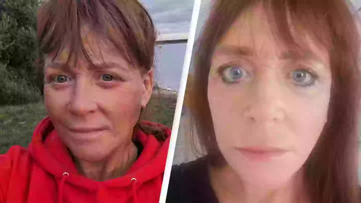 Woman reveals 'horror' surgery to fix her face after weight loss left her unable to close eyes even when she sleepsWoman reveals 'horror' surgery to fix her face after weight loss left her unable to close eyes even when she sleeps Home> News> Health Published 17:32 25 Feb 2025 GMT Woman reveals 'horror' surgery to fix her face after weight loss left her unable to close eyes even when she sleeps Joanne Law described the the hospital where she received treatment as being a 'butcher's shop' Joe Yates Joe Yates Warning: this article contains discussion of body image and beauty standards that some readers may find distressing A mom-of-two has been left unable to close her eyes after flying overseas to undergo cosmetic surgery on the cheap. Joanne Law forked out around $6,500 to fund a face, neck and eyelid lift, as well a fat graft, and while it may be still be an expensive venture, it would have cost her at least double that figure if she had opted for the same operation in her own country, England. In June, 2023, the 56-year-old took a four-hour flight across Europe to go under the knife, having visited the same hospital four months earlier, in February, where she underwent gastric sleeve surgery. Following the success of the first procedure led to Law shedding seven stone, and while she was excited about the weight-loss, it brought about its own problem. "When I lost seven stone I just felt wrinkly, so I thought this is my next step, I'll get my face done," Law, of Manchester, shared. Similar articles to this Powered by Mantis Logo Find more about Man who broke his own legs to add 9 inches to his height speaks out on his experience Man who broke his own legs to add 9 inches to his height speaks out on his experience Man who broke his own legs to add 9 inches to his height speaks out on his experience Find more about Sharon Osbourne reveals 'biggest mistake' she ever made in marriage to Ozzy Osbourne Sharon Osbourne reveals 'biggest mistake' she ever made in marriage to Ozzy Osbourne Sharon Osbourne reveals 'biggest mistake' she ever made in marriage to Ozzy Osbourne Find more about Doctor reveals the one personal item you shouldn't risk sharing after woman was left paralyzed Doctor reveals the one personal item you shouldn't risk sharing after woman was left paralyzed Doctor reveals the one personal item you shouldn't risk sharing after woman was left paralyzed Find more about Former adult film star Emily Willis 'may never move again' after suffering cardiac arrest 7 months ago Former adult film star Emily Willis 'may never move again' after suffering cardiac arrest 7 months ago Former adult film star Emily Willis 'may never move again' after suffering cardiac arrest 7 months ago Find more about Adult film star Emily Willis’ family shares update on star’s critical condition after hospitalization Adult film star Emily Willis’ family shares update on star’s critical condition after hospitalization Adult film star Emily Willis’ family shares update on star’s critical condition after hospitalization Find more about Man faced unthinkable choice when he had to choose whether to cut off his own arm to save his life Man faced unthinkable choice when he had to choose whether to cut off his own arm to save his life Man faced unthinkable choice when he had to choose whether to cut off his own arm to save his life Find more about Men who are actually named James Bond reveal how it has led to dangerous problems Men who are actually named James Bond reveal how it has led to dangerous problems Men who are actually named James Bond reveal how it has led to dangerous problems Find more about Adult film star Emily Willis’ family start GoFundMe after hospitalization for ‘unforeseen battle’ Adult film star Emily Willis’ family start GoFundMe after hospitalization for ‘unforeseen battle’ Adult film star Emily Willis’ family start GoFundMe after hospitalization for ‘unforeseen battle’ Find more about Father of porn star Emily Willis gives shocking update after revealing she is in a coma Father of porn star Emily Willis gives shocking update after revealing she is in a coma Father of porn star Emily Willis gives shocking update after revealing she is in a coma Find more about Eminem hates one of his own songs so much he no longer performs it and cringes when he hears it Eminem hates one of his own songs so much he no longer performs it and cringes when he hears it Eminem hates one of his own songs so much he no longer performs it and cringes when he hears it Find more about Latest update on Emily Willis' health after tragic hospitalization months ago Latest update on Emily Willis' health after tragic hospitalization months ago Latest update on Emily Willis' health after tragic hospitalization months ago Find more about Doctors issue warning about hot showers that could make you rethink your whole bathing routine Doctors issue warning about hot showers that could make you rethink your whole bathing routine Doctors issue warning about hot showers that could make you rethink your whole bathing routine Find more about Expert shares horrifying common mistake people make with sex toys that could put you in the emergency room Expert shares horrifying common mistake people make with sex toys that could put you in the emergency room Expert shares horrifying common mistake people make with sex toys that could put you in the emergency room Find more about Passenger praised for genius response after woman sat in his plane window seat then wanted to switch back Passenger praised for genius response after woman sat in his plane window seat then wanted to switch back Passenger praised for genius response after woman sat in his plane window seat then wanted to switch back Find more about Ariana Grande fans left confused after spotting bizarre way she greeted boyfriend Ethan Slater at SAG Awards Ariana Grande fans left confused after spotting bizarre way she greeted boyfriend Ethan Slater at SAG Awards Ariana Grande fans left confused after spotting bizarre way she greeted boyfriend Ethan Slater at SAG Awards Find more about Denise Richards shares the number one rule she and her daughter have in place for their OnlyFans Denise Richards shares the number one rule she and her daughter have in place for their OnlyFans Denise Richards shares the number one rule she and her daughter have in place for their OnlyFans Find more about Panic! At The Disco fans are only just realizing true meaning behind band's name Panic! At The Disco fans are only just realizing true meaning behind band's name Panic! At The Disco fans are only just realizing true meaning behind band's name Find more about What exactly was said in 'burn after reading' letter given to Brian Laundrie from his mom What exactly was said in 'burn after reading' letter given to Brian Laundrie from his mom What exactly was said in 'burn after reading' letter given to Brian Laundrie from his mom Find more about Man who did 10,001 pull-ups in one day leaves people horrified after revealing painful effects it had on his body Man who did 10,001 pull-ups in one day leaves people horrified after revealing painful effects it had on his body Man who did 10,001 pull-ups in one day leaves people horrified after revealing painful effects it had on his body Find more about Alec Baldwin opens up about fatal Rust shooting in new reality TV show and admits he's 'happier when asleep' Alec Baldwin opens up about fatal Rust shooting in new reality TV show and admits he's 'happier when asleep' Alec Baldwin opens up about fatal Rust shooting in new reality TV show and admits he's 'happier when asleep' Find more about Man who broke his own legs to add 9 inches to his height speaks out on his experience Man who broke his own legs to add 9 inches to his height speaks out on his experience Man who broke his own legs to add 9 inches to his height speaks out on his experience Find more about Sharon Osbourne reveals 'biggest mistake' she ever made in marriage to Ozzy Osbourne Sharon Osbourne reveals 'biggest mistake' she ever made in marriage to Ozzy Osbourne Sharon Osbourne reveals 'biggest mistake' she ever made in marriage to Ozzy Osbourne "I was chuffed the whole time, and that was my downfall. I didn't research enough because I trusted them. "The procedure was around the back of the hospital in a basement. It frightened the hell out of me, it was awful, like a horror movie." She continued: "There was an old-fashioned bed screen separator, someone was being operated on the other side in the same theatre. Joanne Law spent thousands on a botched surgery in Turkey (Kennedy)Joanne Law spent thousands on a botched surgery in Turkey (Kennedy) Joanne Law spent thousands on a botched surgery in Turkey (Kennedy) "Immediately after I got blepharitis, which is a bacterial infection, and had blisters under my eyes for three months. "I still can't fully close my eyes now. I'm struggling to drive at night now because the car lights hurt my eyes and I just can't close them." Law went on to explain how she struggles to get around during windy conditions, and how she even has to pull over at service stations often while driving because she described how her eyes 'droop', and being unable to shut them it feels 'as if I've had no sleep for a week'. The ordeal has knocked her confidence, with Law confessing that she no longer likes leaving the house as people comment on how 'tired' she looks. Law has labeled the hospital a 'butcher's shop' after surgery left her unable to close her eyes (Kennedy)Law has labeled the hospital a 'butcher's shop' after surgery left her unable to close her eyes (Kennedy) Law has labeled the hospital a 'butcher's shop' after surgery left her unable to close her eyes (Kennedy) Now, the Mancunian hopes to raise awareness to prevent others from taking the trip to Turkey, be that from the UK, the US or Canada. "What made me suspicious was before I went in, is that I couldn't find any before and after photographs of the surgeon's work," Law explained. "I remember he fobbed me off to the point that I believed him. I was excited about what I was going to have done and ignored my gut feeling. "I've been so frustrated, I want to scream to other girls and say don't do it." Before adding: "The recovery was horrendous, there was no aftercare. That hospital is a butcher's shop."