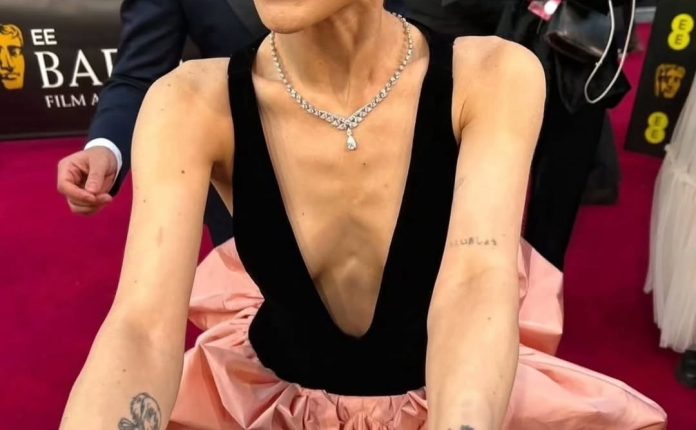 Concerns have circulated (especially after her recent appearances at events like BAFTA and Met Gala)
