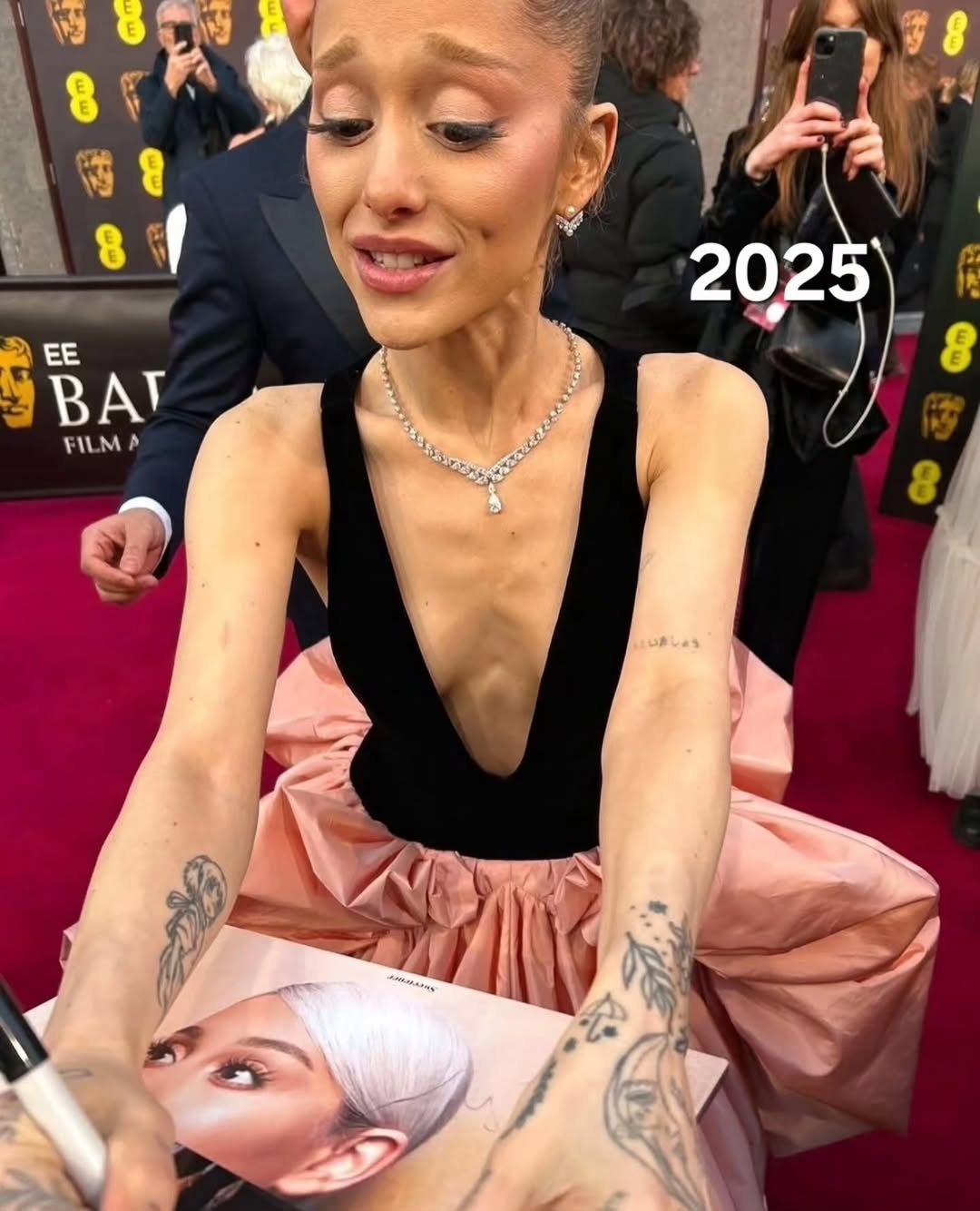 Concerns have circulated (especially after her recent appearances at events like BAFTA and Met Gala)