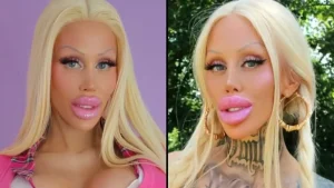 The woman revealed what she looked like before her $336k plastic surgery transformation