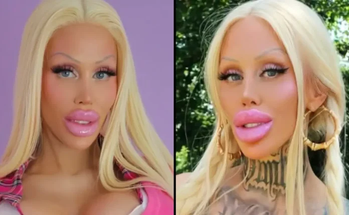 The woman revealed what she looked like before her $336k plastic surgery transformation