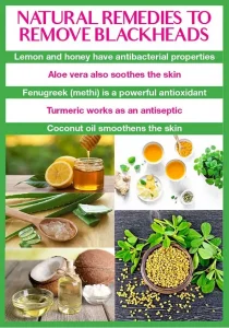 Simple and Effective Natural Remedies for Blackheads Removal