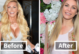 These 20 Celebs Had Their Breast Implants Removed—Before And After Photos Revealed