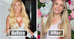 These 20 Celebs Had Their Breast Implants Removed—Before And After Photos Revealed