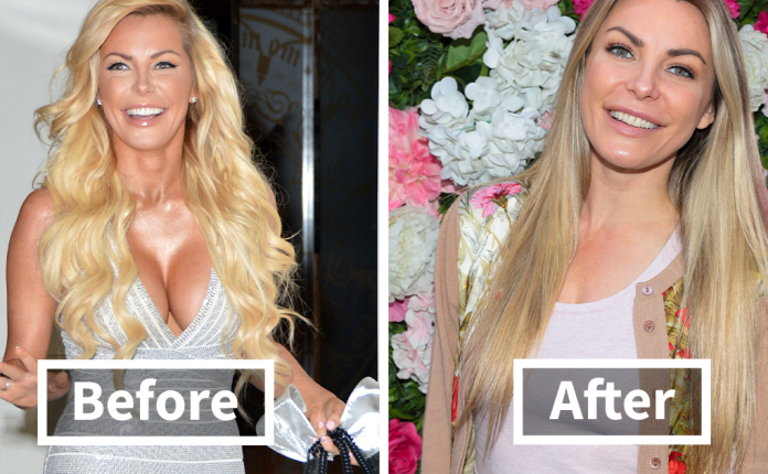 These 20 Celebs Had Their Breast Implants Removed—Before And After Photos Revealed