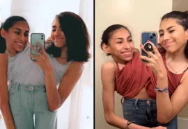 Conjoined Twin Carmen Andrade Is Now Married
