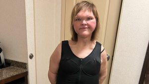 1000-Lb. Sisters’ Tammy Slaton Barely Recognizable After Showing Off Skin Removal Surgery Results