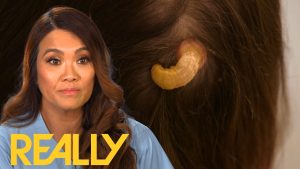 Dr. Pimple Popper Removes A Potentially Cancerous Horn from a Woman’s Head (Video)