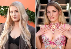 Stars Who Love Their Plastic Surgery