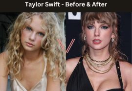 Taylor Swift Breast Implant Before and After