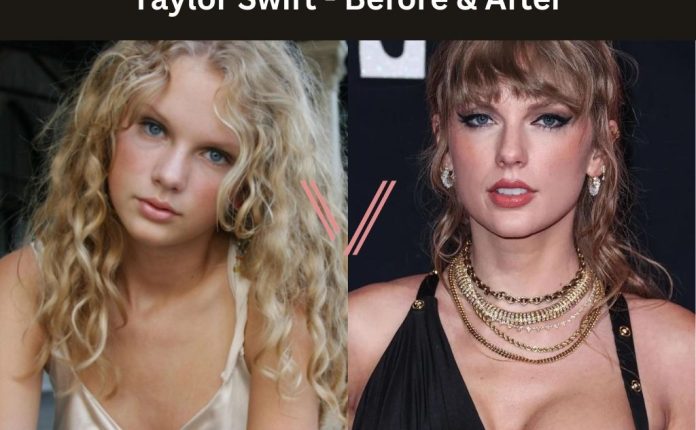Taylor Swift Breast Implant Before and After