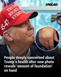 People deeply concerned about Trump’s health after new photo reveals ‘amount of foundation’ on hand