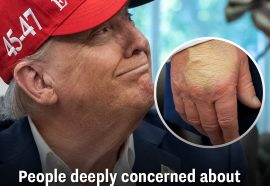 People deeply concerned about Trump's health after new photo reveals 'amount of foundation' on hand