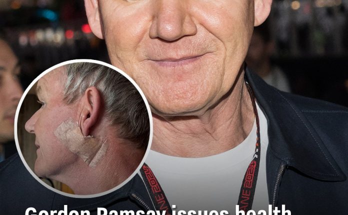 Gordon Ramsay issues health warning after undergoing cancer surgery