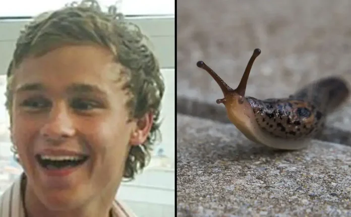 Man Ate Slug After Being Dared By His Friends And It Ended In Tragedy