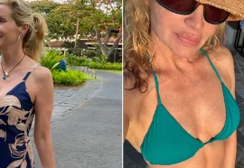 Celebrity Plastic Surgery Reveals and Beauty Confessions of 2025