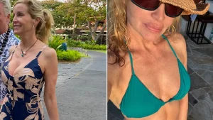 Celebrity Plastic Surgery Reveals and Beauty Confessions of 2025