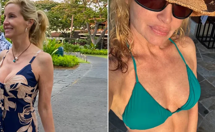 Celebrity Plastic Surgery Reveals and Beauty Confessions of 2025