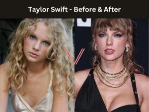 American Celebrities with Breast Implants | Before & After Photos