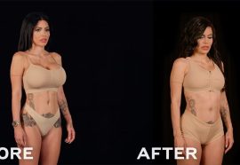 Meghan Trainor Unveils Before-and-After of Boob Job