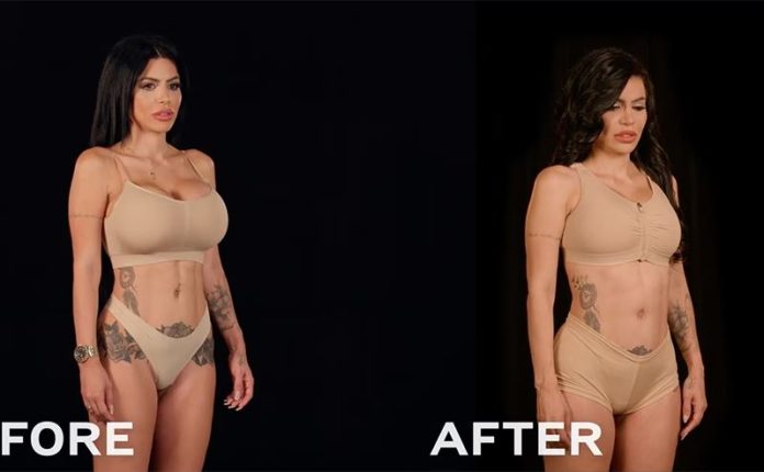 Meghan Trainor Unveils Before-and-After of Boob Job