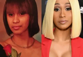 Celebrity Plastic Surgery: 30 Before-and-After Pics