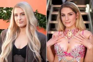 Stars Who Love Their Plastic Surgery